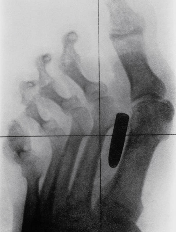 Фотография: Cамые странные рентгеновские снимки №3 - BigPicture.ru